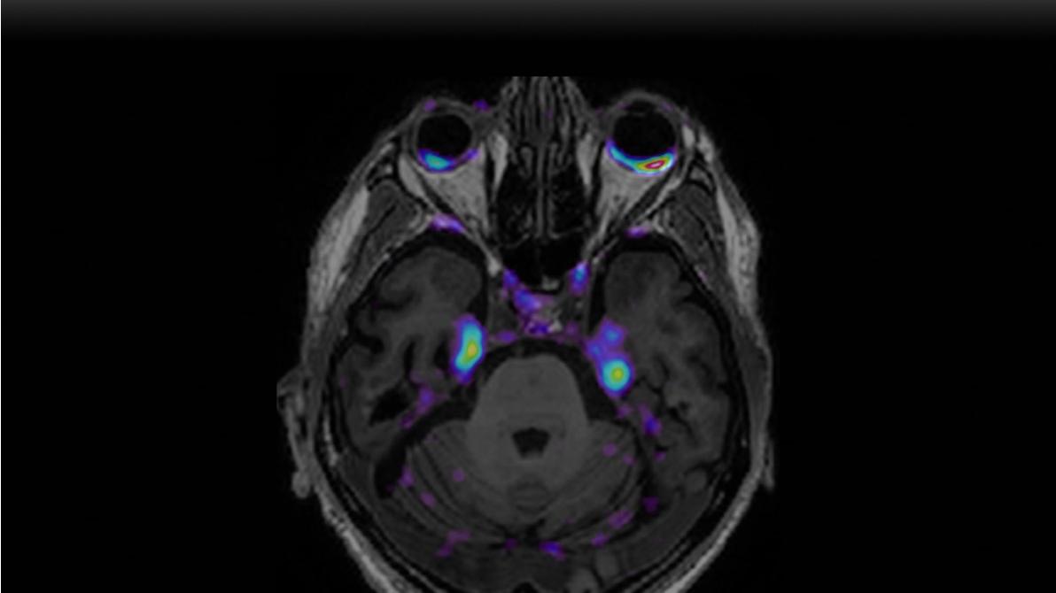 Placeholder image